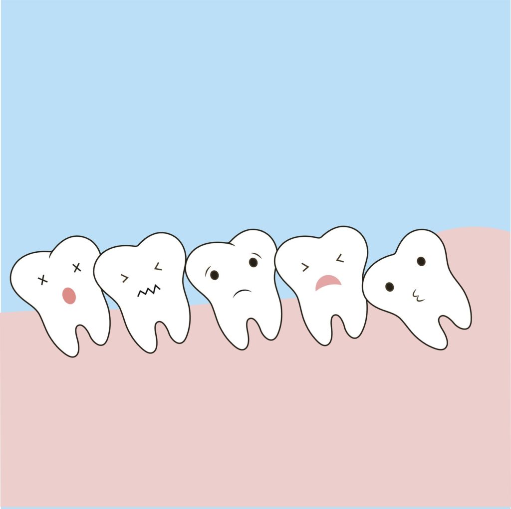 Cartoon graphic of painfully crowded teeth, indicating an unhealthy gum line