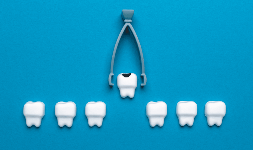 Root Canal vs Tooth Extraction: Which is the Right Option for Me? cover