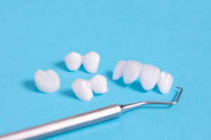 Are Dental Crowns Permanent? A Guide to Dental Crowns cover