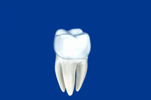 When is it Necessary to Get a Dental Crown? cover