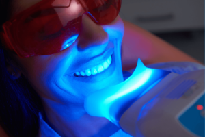 Why is Professional Teeth Whitening Important? cover