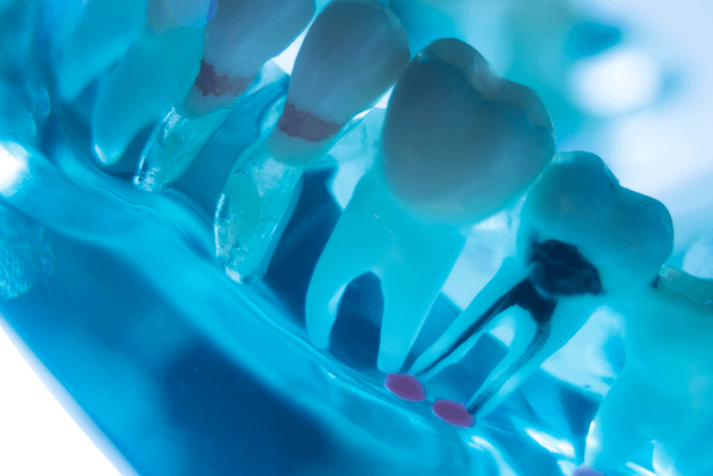 What are All of the Stages of Periodontal Disease? cover