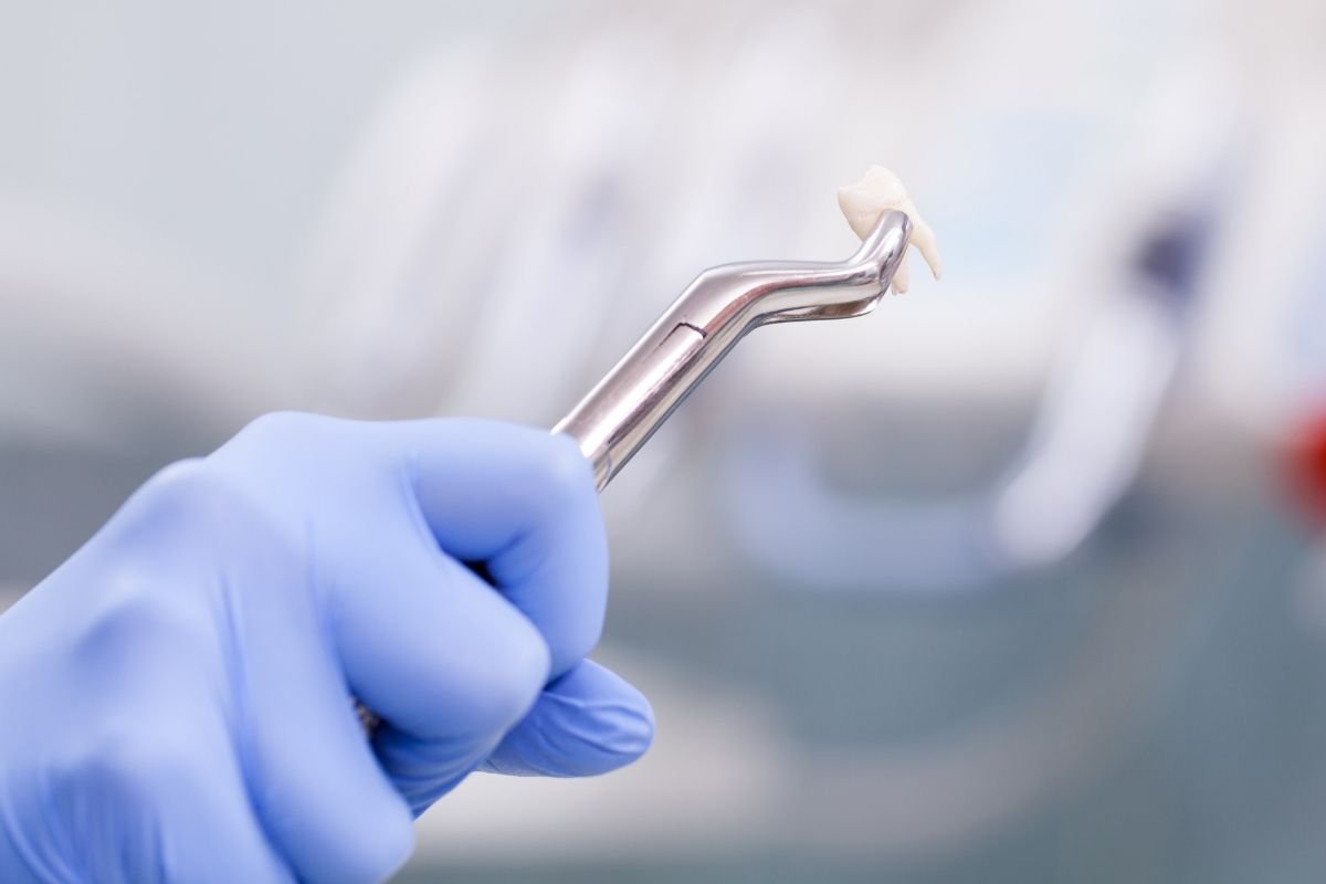 When is it Necessary to Have a Tooth Extracted? cover