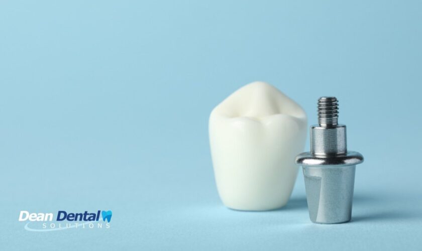 Are Dental Implants Worth It For Long-Term Oral Health? cover