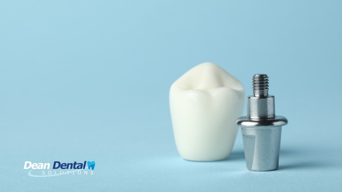 Are Dental Implants Worth It For Long-Term Oral Health? cover