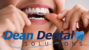 Mouth Guard for Grinding Teeth: Does It Really Help? cover