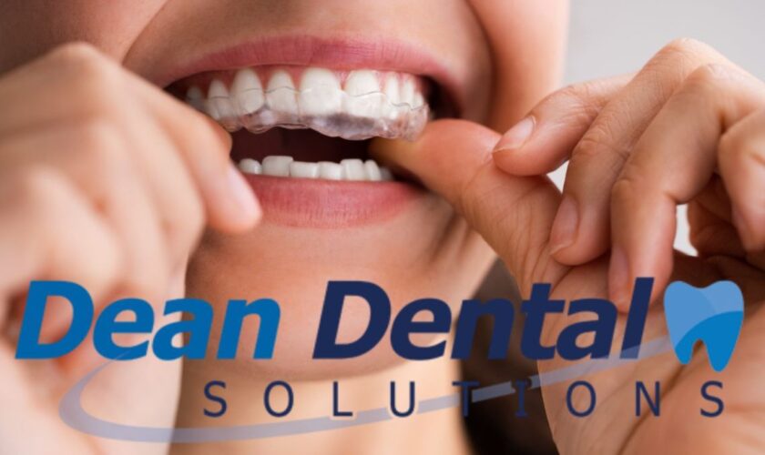 Mouth Guard for Grinding Teeth: Does It Really Help? cover
