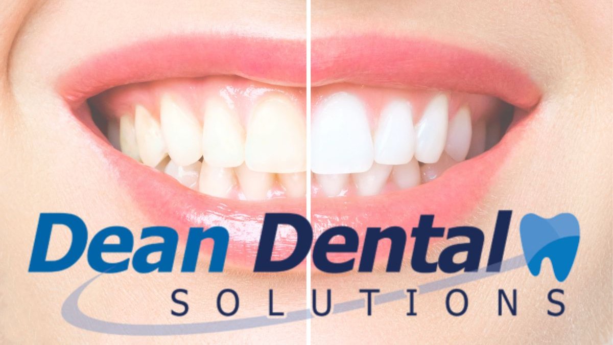 Tooth Sensitivity After Whitening