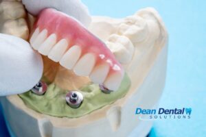 Permanent Dentures vs Removable: Which Should You Choose? cover