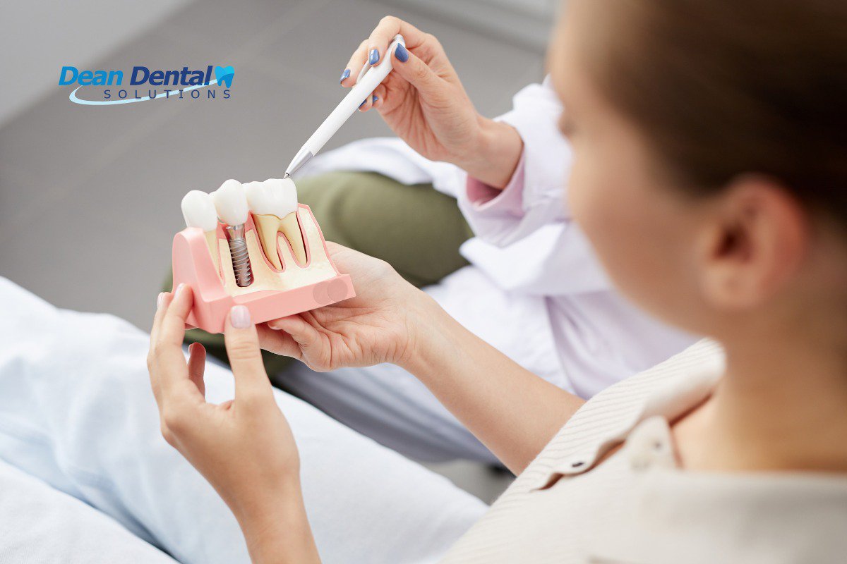 Discover What Dental Implants Are: Everything You Need to Know for Your New Smile cover