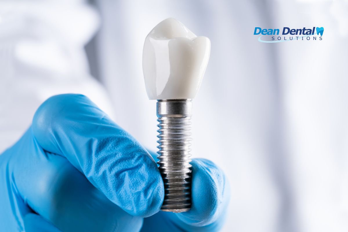 Looking For Dental Implant Providers in North Little Rock? Let’s Talk cover