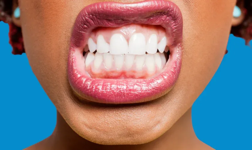 Infographic illustrating daytime habits and dental solutions to stop teeth clenching and bruxism