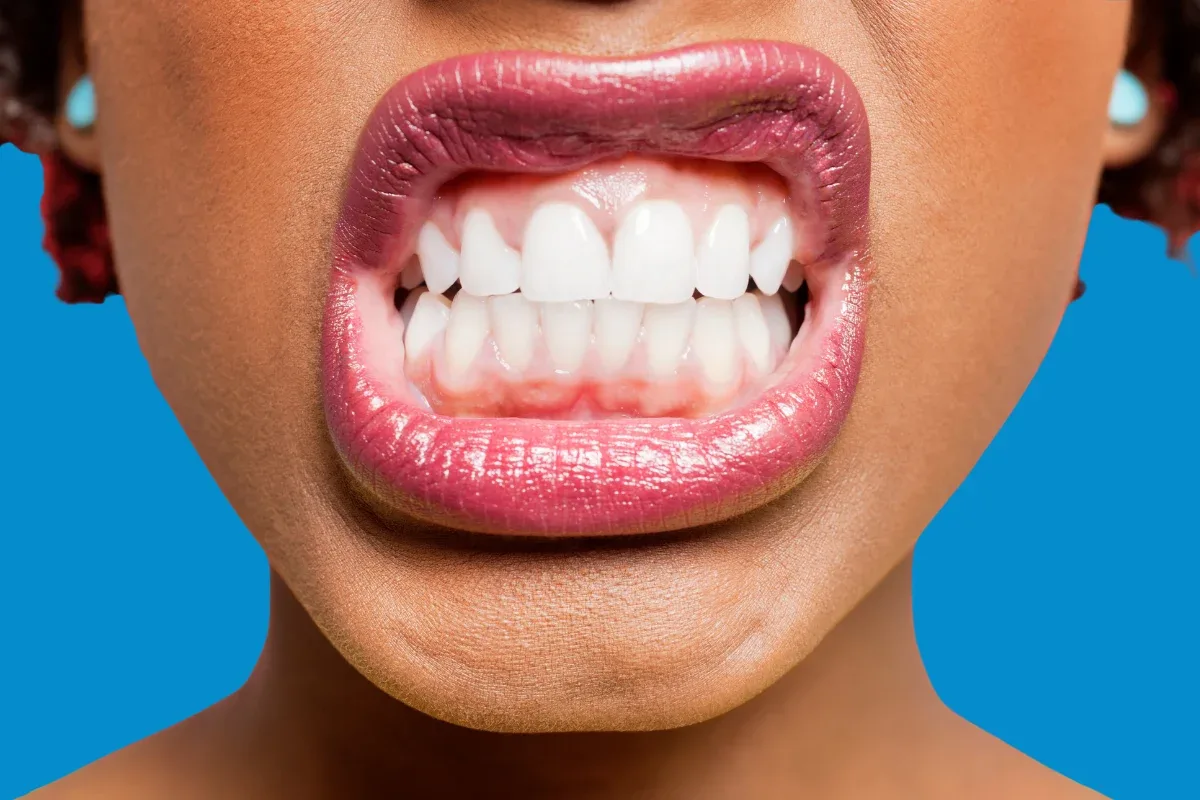 Infographic illustrating daytime habits and dental solutions to stop teeth clenching and bruxism